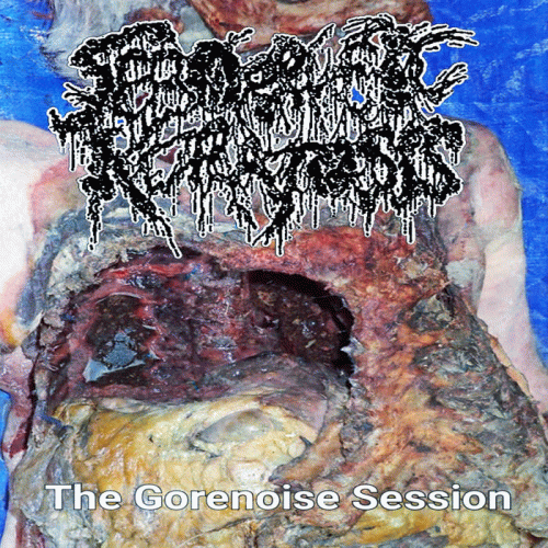 Seborrheic Keratosis : The Gorenoise Session